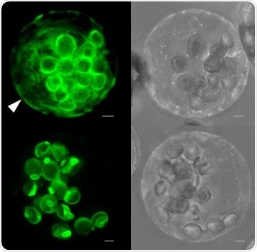 Study identifies significant role of membrane proteins in metabolic processes of plants