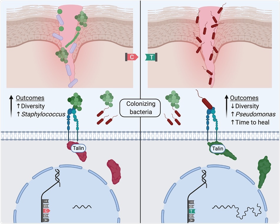 Study shows microbiome can determine the wound healing process