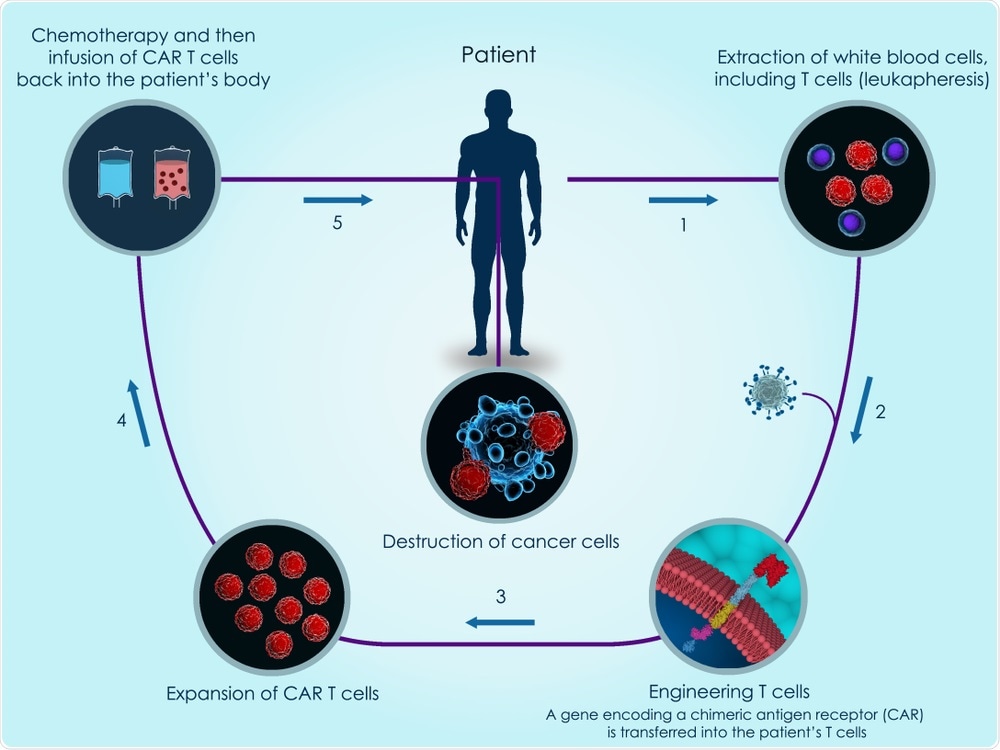 CAR T Cell Therapy CAR T Cell Therapy