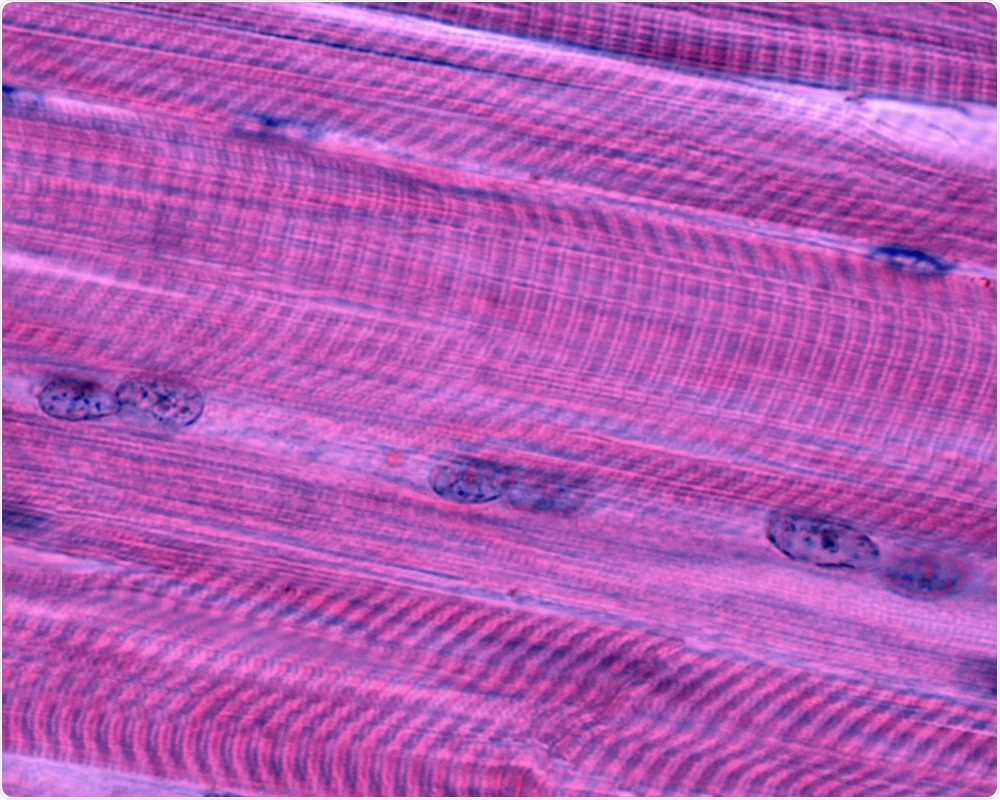 Muscle Fiber Muscle Fiber