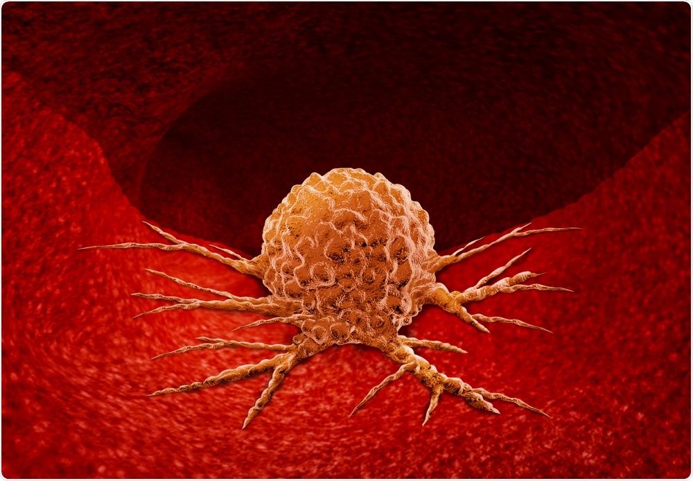 Cancer Tumor Cancer Tumor