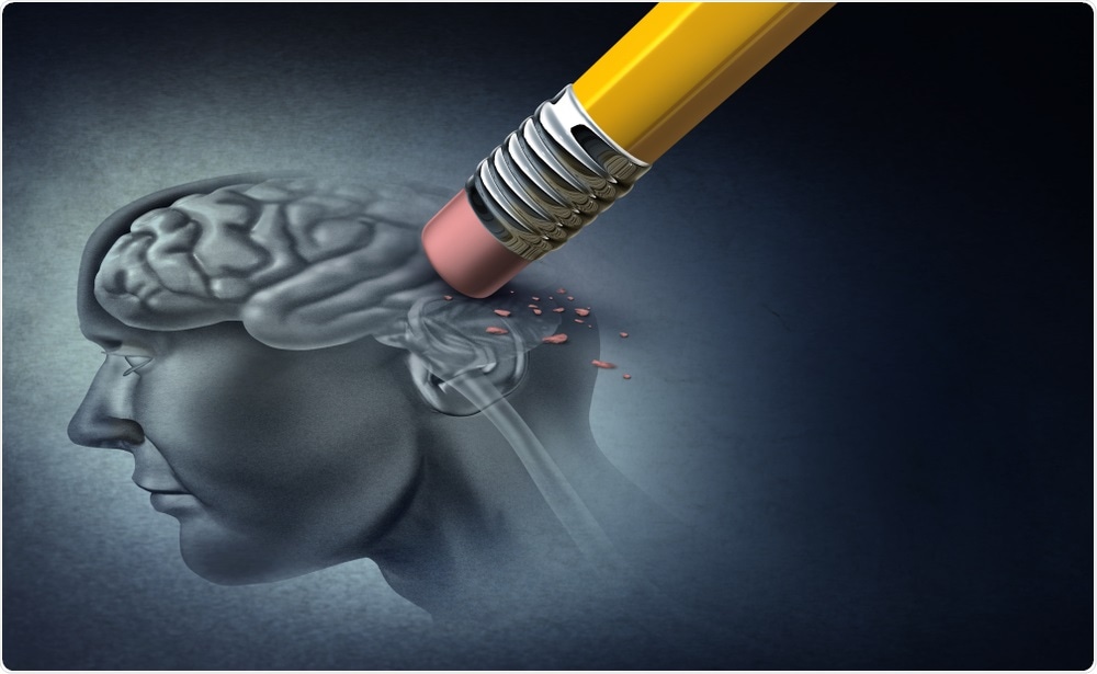 Alzheimers Disease Alzheimers Disease