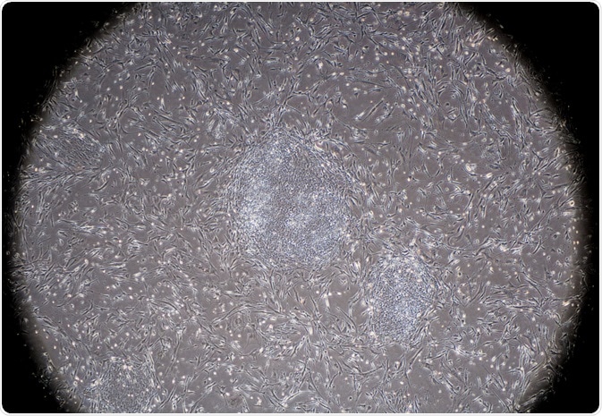Human Induced Pluripotent Stem Cells Human Induced Pluripotent Stem Cells