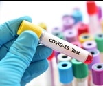 COVID-19 Antibody Tests: How Reliable Are They?