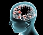 Subtypes in alzheimer's disease may be linked to tau protein modifications