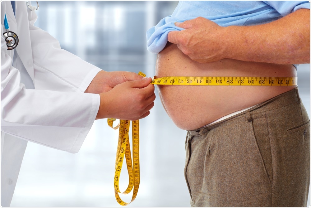 Obesity Obesity