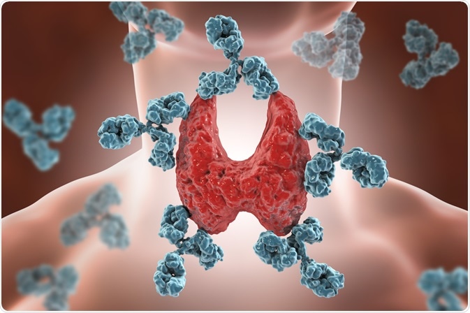 Autoimmune Thyroiditis Autoimmune Thyroiditis