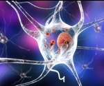 Solving A Parkinson's Disease Puzzle Through Protein Design