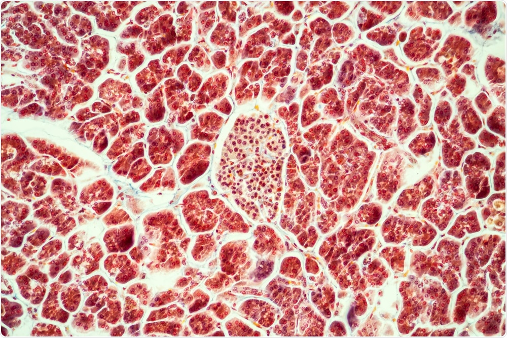 Pancreas with Islet Cells Pancreas with Islet Cells