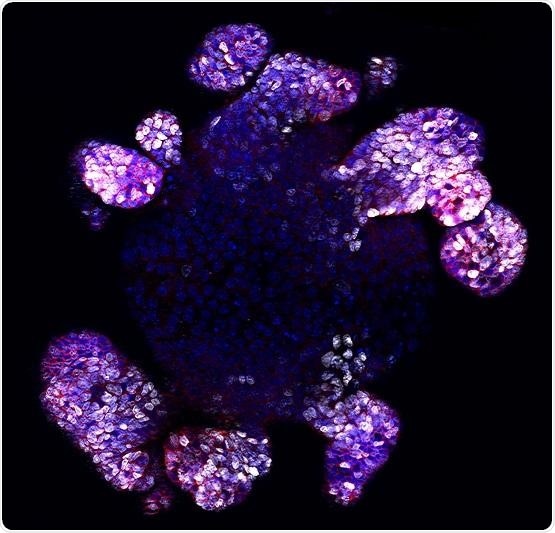 Researchers identify key molecule that repairs the gut lining