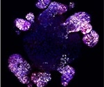 Researchers identify key molecule that repairs the gut lining