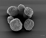 SOAT1 enzyme offers a promising therapeutic target for pancreatic cancer