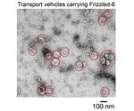 Study identifies a new target for cancer treatment