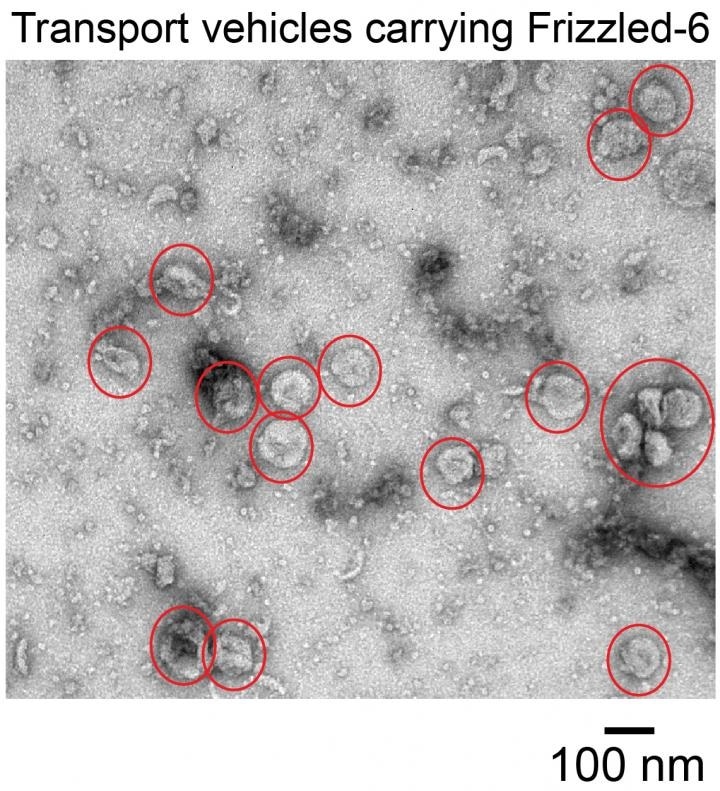 Study identifies a new target for cancer treatment