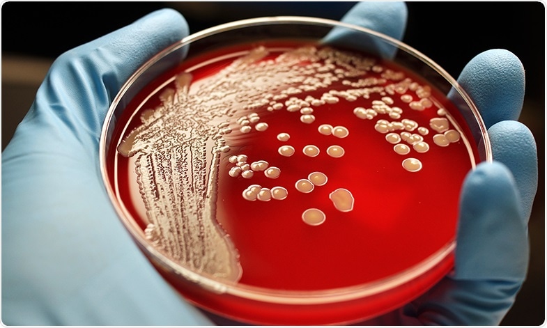 Study shows genetic mutations allow MRSA to develop antibiotic resistance