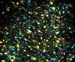 DNA sequencing method maps long-range connections between brain regions
