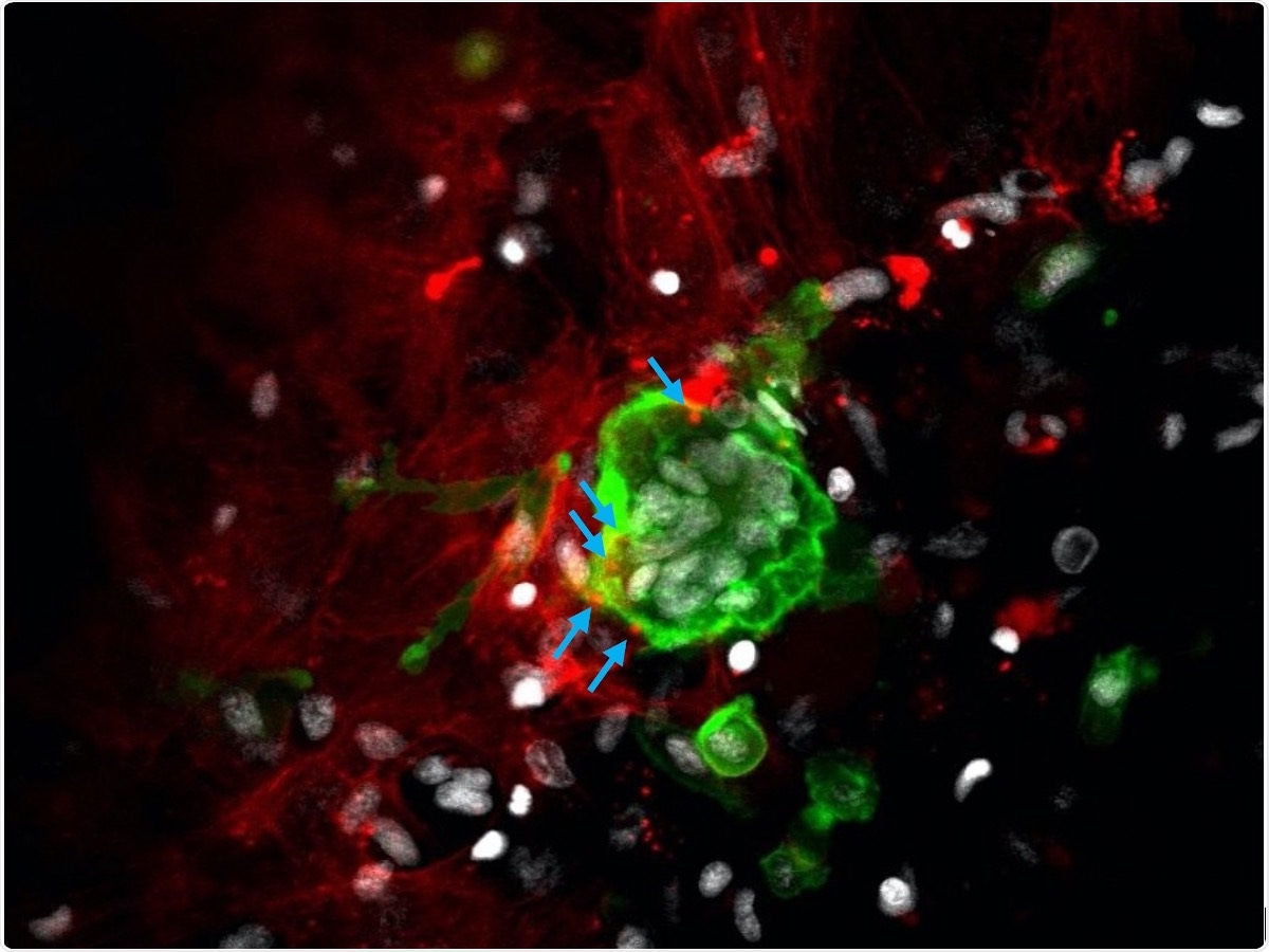 New study can help treat metabolic and genetic bone diseases