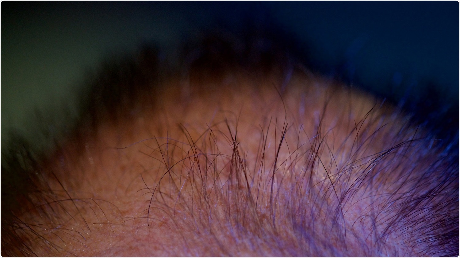 Study pinpoints the miRNA that promotes hair follicle growth