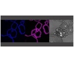 Organoids reveal inflammatory processes that play a role in infectious diseases