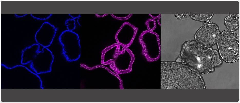 Organoids reveal inflammatory processes that play a role in infectious diseases