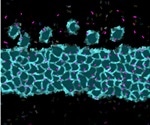 Novel therapeutics targeting primary cilia may reverse neurodevelopmental disorders