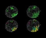Study reveals key factor that influences malignant cells to develop into tumor
