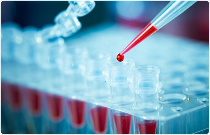 PCR DNA Analysis PCR DNA Analysis