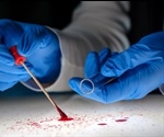 Bioinformatics Role in Forensic DNA