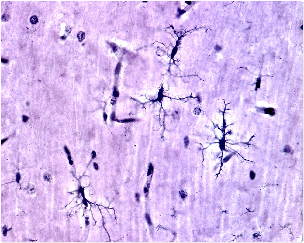 Microglia Cells Microglia Cells