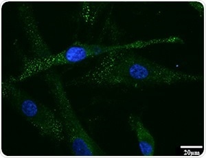 Researchers identify protein that causes adverse side effects in gastric cancer patients