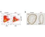Researchers identify a novel molecular mechanism of intestinal stem cells