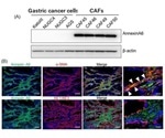 Study shows Annexin molecule promotes resistance to anticancer drugs
