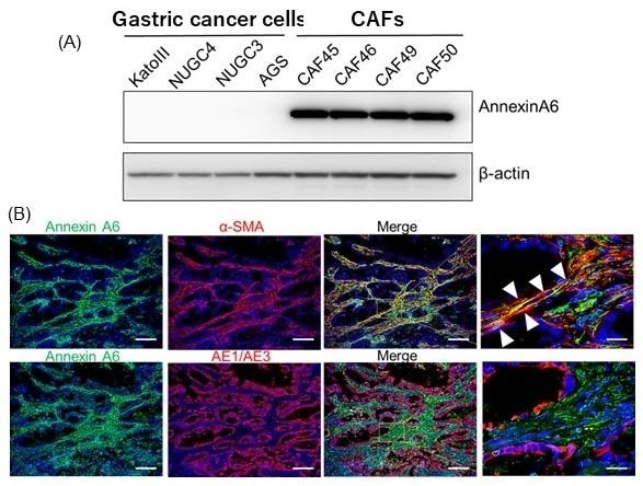 Study shows Annexin molecule promotes resistance to anticancer drugs