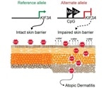 Study sheds light on genetic and molecular mechanisms involved in atopic dermatitis
