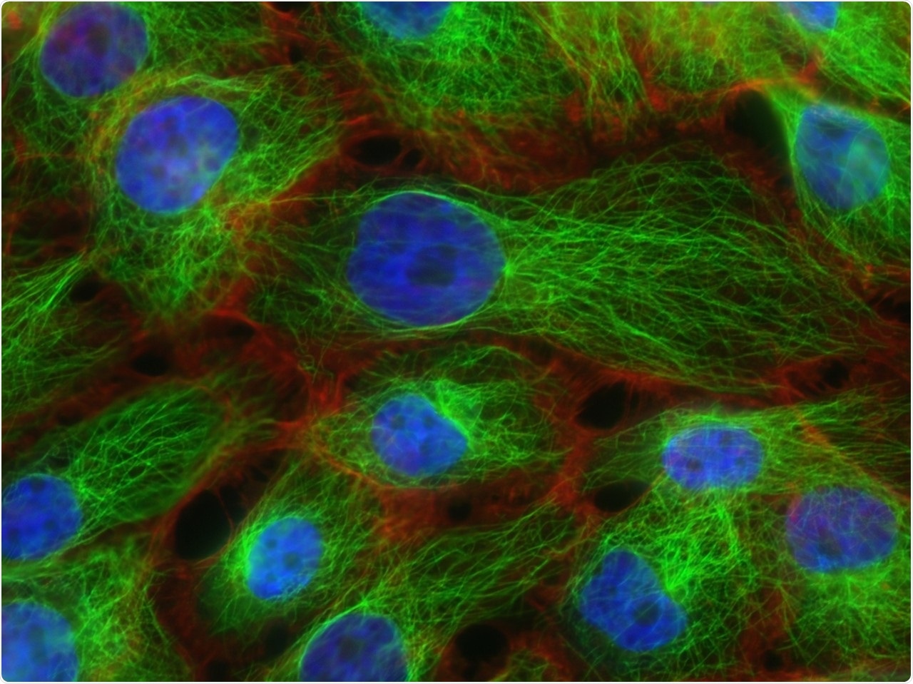 New study can help eliminate treatment resistance in breast cancer