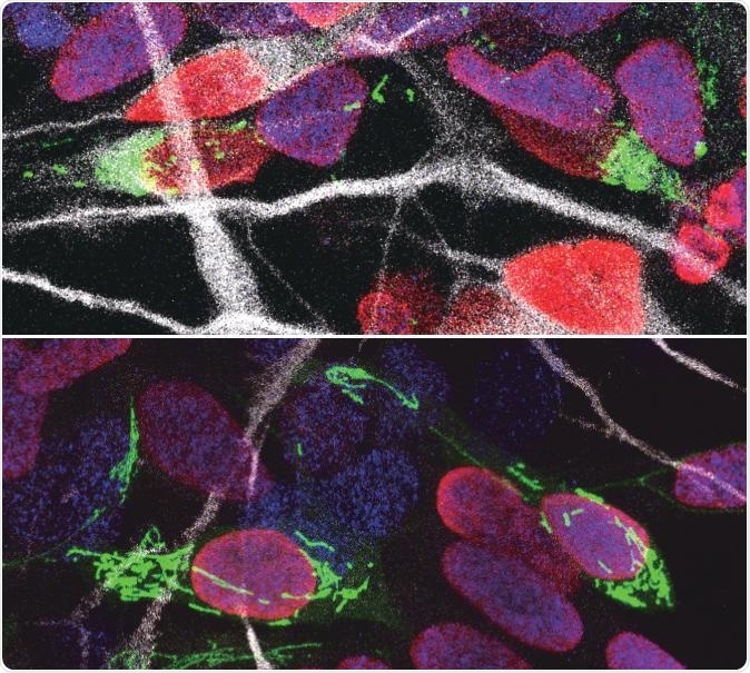Study shows how mitochondrial defects lead to neurodevelopmental diseases