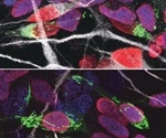 Study shows how mitochondrial defects lead to neurodevelopmental diseases