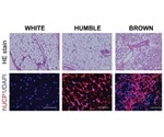 New method shows promise for treating diabetes and obesity
