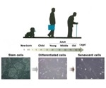 Genetic analysis reveals the inhibitory role of NSD2 enzyme in cellular senescence