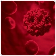 Researchers develop new, rapid test to diagnose COVID-19 Researchers develop new, rapid test to diagnose COVID-19