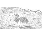 Researchers identify new mechanism of papillomavirus that tricks the human immune system