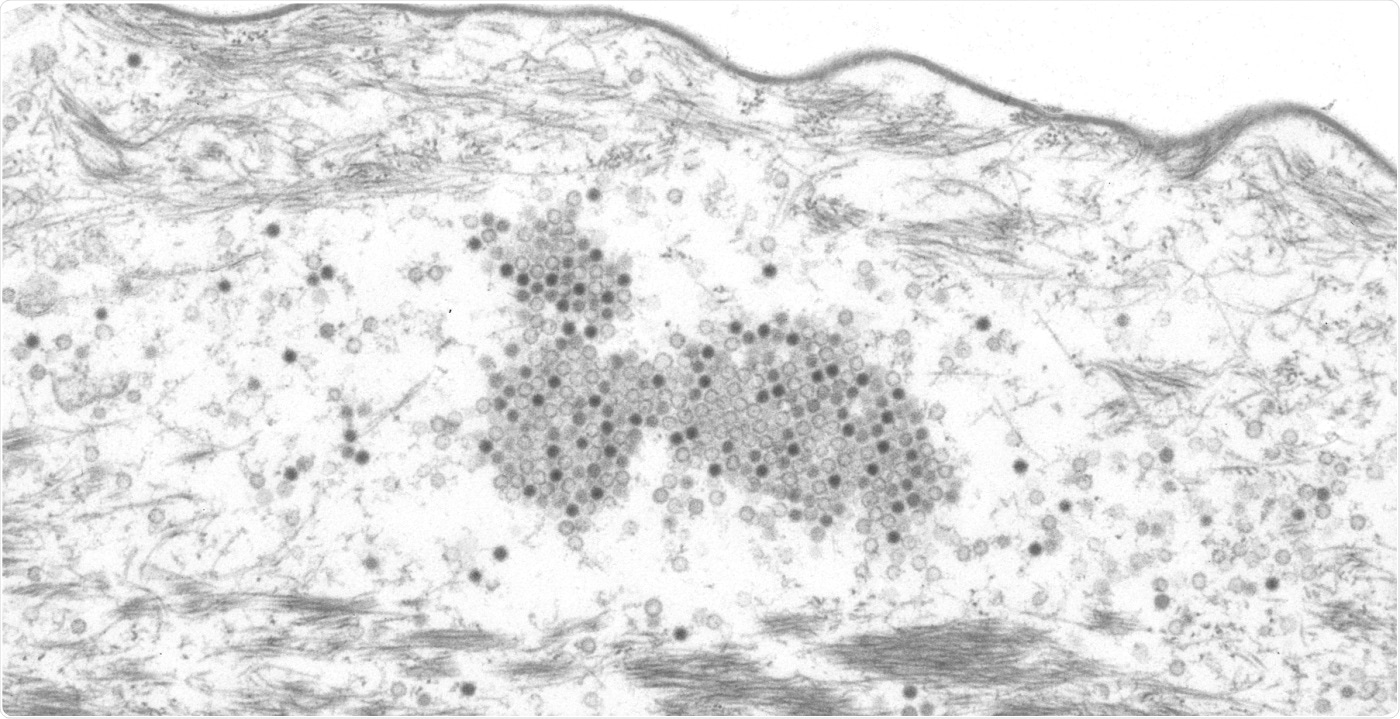 Researchers identify new mechanism of papillomavirus that tricks the human immune system