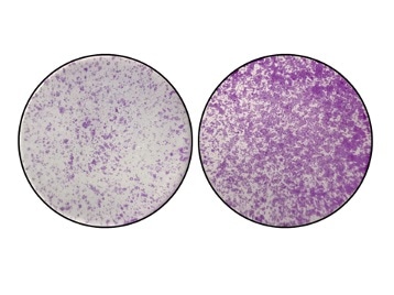 Researchers solve an ancient cancer mystery