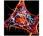 New method helps track actin involved in mitochondrial dysfunction