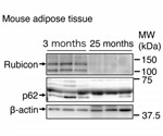 Researchers identify key protein involved in age-related disorders