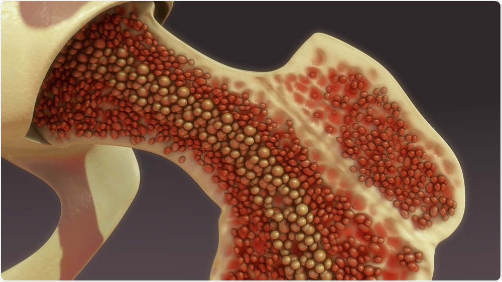 Bone Marrow Cells Bone Marrow Cells