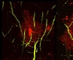 Researchers identify brain protein that leads to seizures, abnormal social behaviors