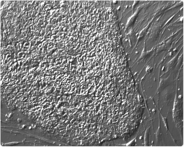 Researchers identify the targets of immune rejection