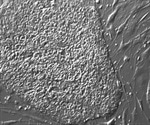 Researchers identify the targets of immune rejection