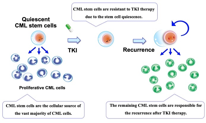 Researchers identify new way to treat chronic myelogenous leukemia